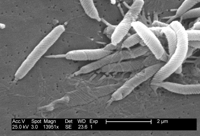 Industrial Monitor - Corning's first antimicrobial touchscreen display a close-up of a group of bacteria